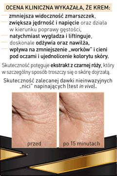 //www.ros.net.pl/GalleryImages/product_photos/360_350/330126_381433_360_350.png